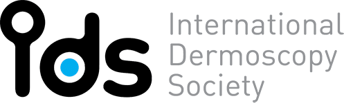 International Dermoscopy Society (IDS)